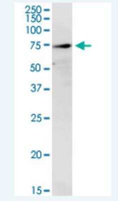 Western Blot: TREH Antibody (2D10) [H00011181-M02-100ug]