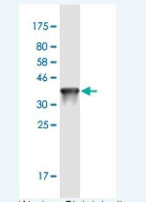 Western Blot: TREH Antibody (2D10) [H00011181-M02-100ug]