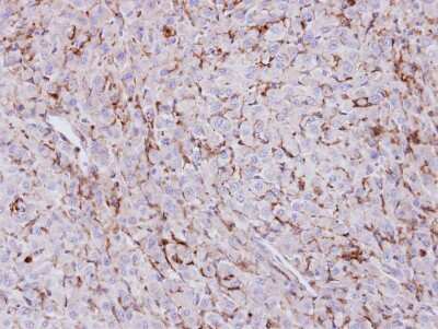 Immunohistochemistry-Paraffin: TREH Antibody [NBP1-32794]