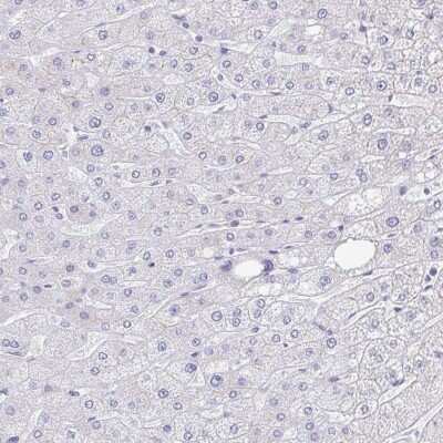 Immunohistochemistry-Paraffin: TREH Antibody [NBP1-82756]