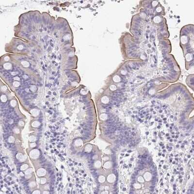 Immunohistochemistry-Paraffin: TREH Antibody [NBP1-82756]