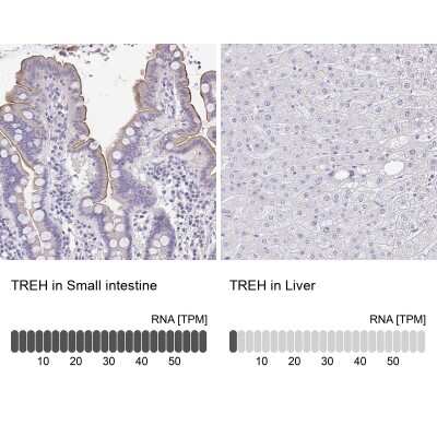 Immunohistochemistry-Paraffin: TREH Antibody [NBP1-82756]