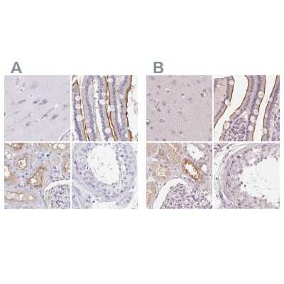 Immunohistochemistry-Paraffin: TREH Antibody [NBP1-82756]