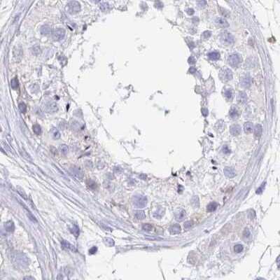 Immunohistochemistry-Paraffin: TREH Antibody [NBP1-82756]