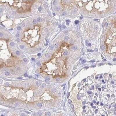 Immunohistochemistry-Paraffin: TREH Antibody [NBP1-82756]