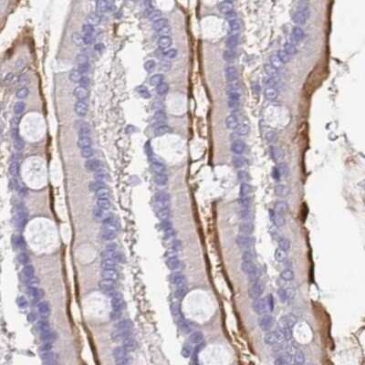Immunohistochemistry-Paraffin: TREH Antibody [NBP1-82756]