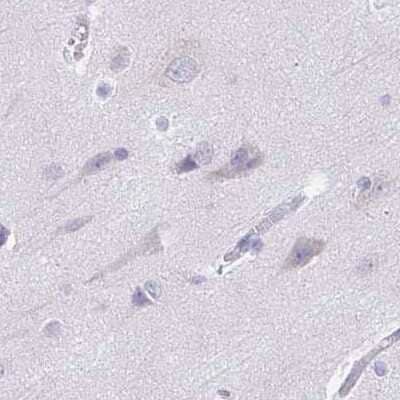 Immunohistochemistry-Paraffin: TREH Antibody [NBP1-82756]