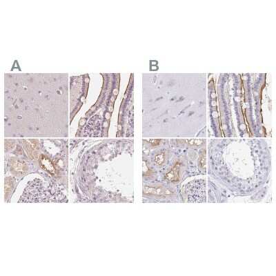 Immunohistochemistry-Paraffin: TREH Antibody [NBP2-48756]
