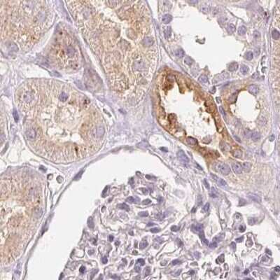 Immunohistochemistry-Paraffin: TREH Antibody [NBP2-48756]