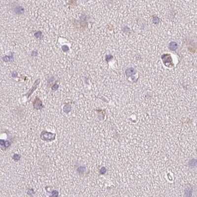 Immunohistochemistry-Paraffin: TREH Antibody [NBP2-48756]