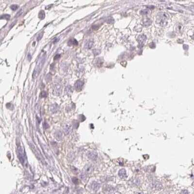 Immunohistochemistry-Paraffin: TREH Antibody [NBP2-48756]