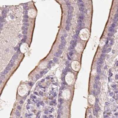 Immunohistochemistry-Paraffin: TREH Antibody [NBP2-48756]