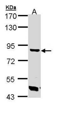 Western Blot: TREH Antibody [NBP1-32794]