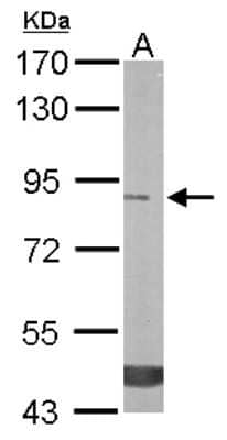 Western Blot: TREH Antibody [NBP1-32794]