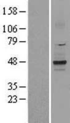 Western Blot: TREK 1 Overexpression Lysate [NBL1-12182]