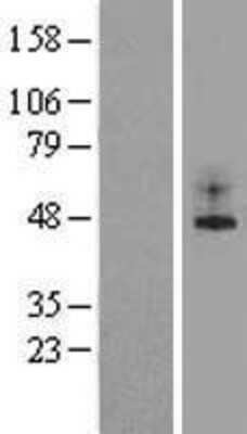 Western Blot: TREK 1 Overexpression Lysate [NBL1-12183]