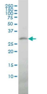 Western Blot: TREM1 Antibody (2E2) [H00054210-M04]