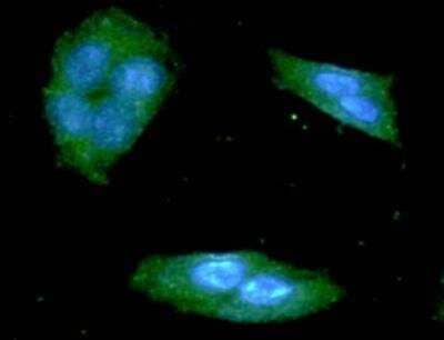 Immunocytochemistry/ Immunofluorescence: TREM2 Antibody (2B5) - BSA Free [NBP1-07101]