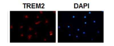 Immunocytochemistry: TREM2b Antibody (RM0139-5J46) - Azide and BSA Free [NBP1-22515]
