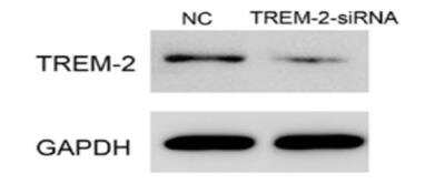 Western Blot: TREM2b Antibody (RM0139-5J46)Azide and BSA Free [NBP1-22515]