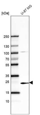 Western Blot: TREM1 Antibody (CL7111) [NBP2-76531]