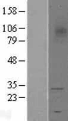 Western Blot: TREM1 Overexpression Lysate [NBL1-17264]