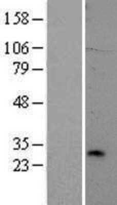 Western Blot: TREM2 Overexpression Lysate [NBP2-06751]