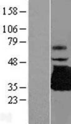 Western Blot: TREML1/TLT-1 Overexpression Lysate [NBL1-17265]