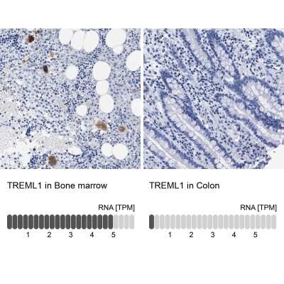 Immunohistochemistry-Paraffin: TREML1/TLT-1 Antibody [NBP1-84234]