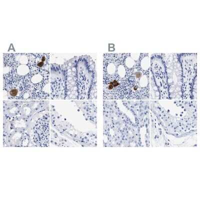 Immunohistochemistry-Paraffin: TREML1/TLT-1 Antibody [NBP1-84234]