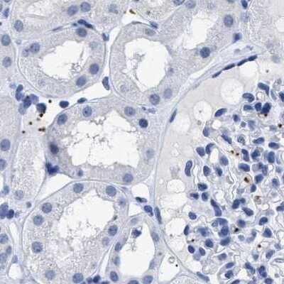 Immunohistochemistry-Paraffin: TREML1/TLT-1 Antibody [NBP1-84234]