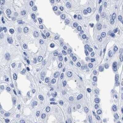 Immunohistochemistry-Paraffin: TREML1/TLT-1 Antibody [NBP1-84235]