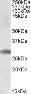 Western Blot: TREML1/TLT-1 Antibody [NBP1-45208]