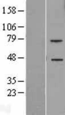 Western Blot: TREML2/TLT-2 Overexpression Lysate [NBP2-06287]