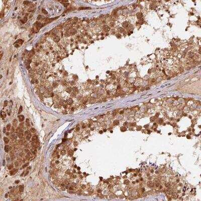 Immunohistochemistry-Paraffin: TREML4/TLT-4 Antibody [NBP2-38059]