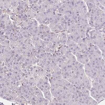 Immunohistochemistry-Paraffin: TRERF1 Antibody [NBP2-38883]