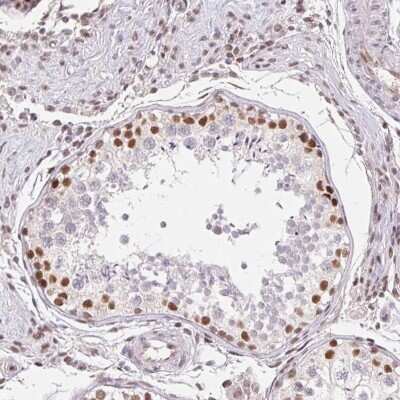 Immunohistochemistry-Paraffin: TRERF1 Antibody [NBP2-38883]