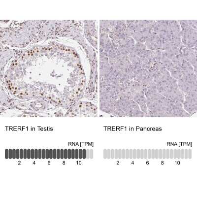 Immunohistochemistry-Paraffin: TRERF1 Antibody [NBP2-38883]