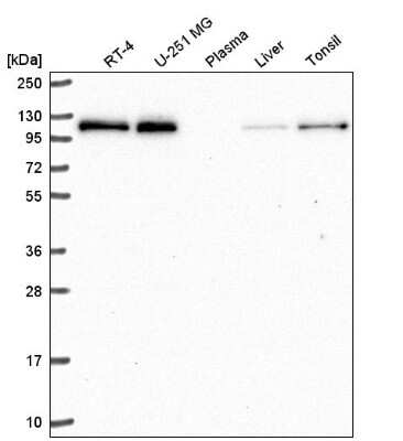 Western Blot: TRERF1 Antibody [NBP2-56238]