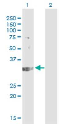 Western Blot: TREX1 Antibody (2F10) [H00011277-M01]