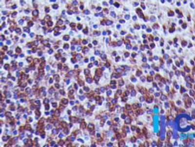 Immunohistochemistry-Paraffin: TREX1 Antibody (41M5F2) [NBP2-22394]