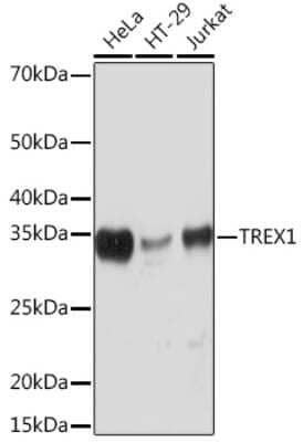 Western Blot: TREX1 Antibody (7Q0G6) [NBP3-16281]