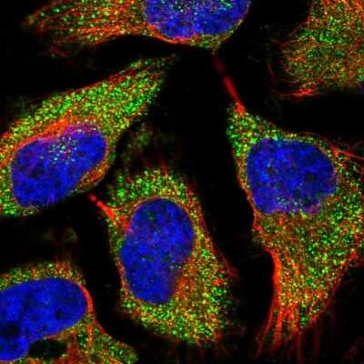 Immunocytochemistry/ Immunofluorescence: TREX1 Antibody [NBP2-68672]