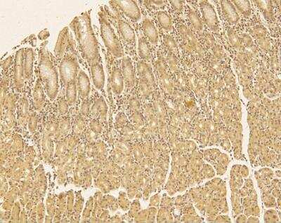Immunohistochemistry-Frozen: TREX1 Antibody - BSA Free [NBP2-29617]