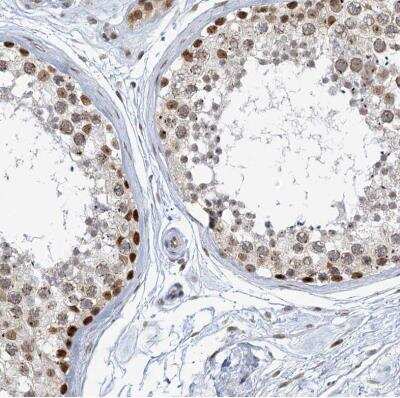 Immunohistochemistry-Paraffin: TREX1 Antibody [NBP1-89202]