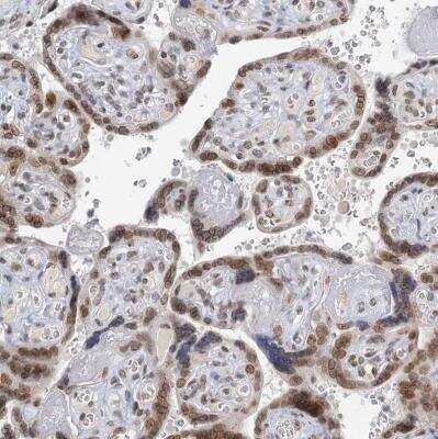 Immunohistochemistry-Paraffin: TREX1 Antibody [NBP1-89202]