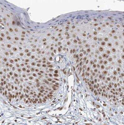 Immunohistochemistry-Paraffin: TREX1 Antibody [NBP1-89202]