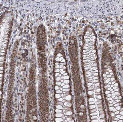 Immunohistochemistry-Paraffin: TREX1 Antibody [NBP1-89202]