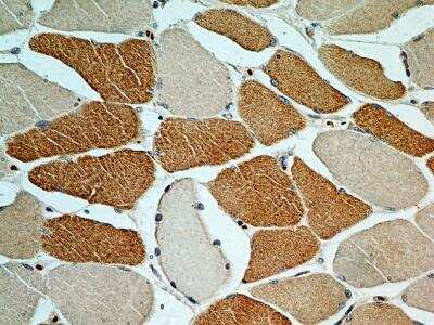 Immunohistochemistry-Paraffin: TREX1 Antibody - BSA Free [NBP2-29617]