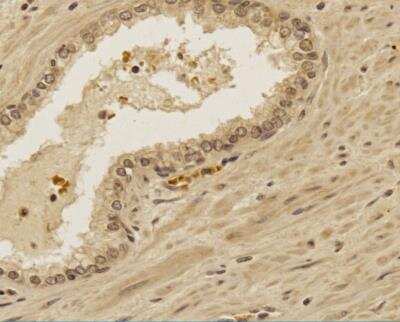 Immunohistochemistry-Paraffin: TREX1 Antibody - BSA Free [NBP2-29617]
